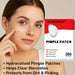 360Count Acne Patch Covers Pimple