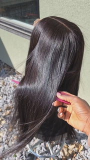 Donor Hair: The Key to Successful Hair Transplants